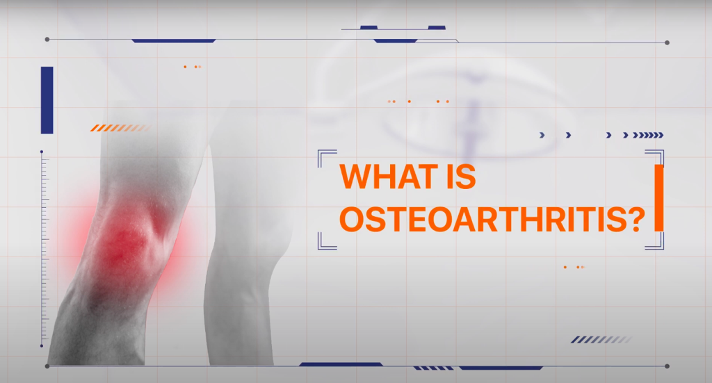 What is Osteoarthritis.png