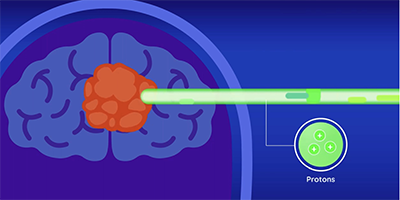 Precise targeting in proton therapy - NCCS