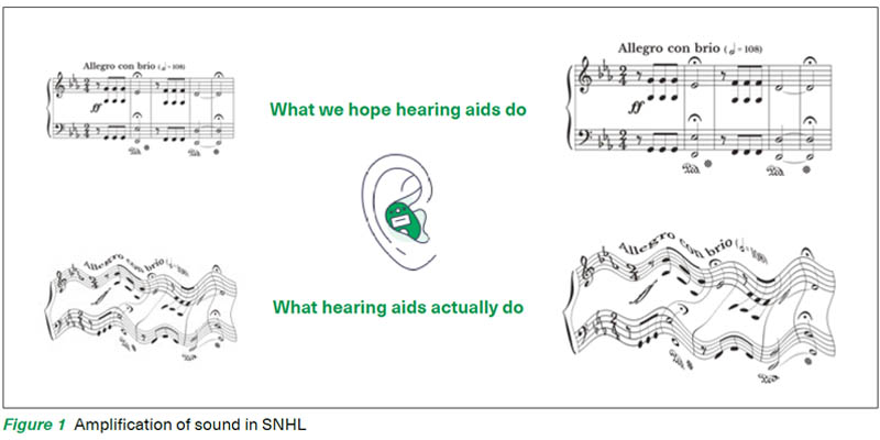 Amplication of sound - Singapore General Hospital