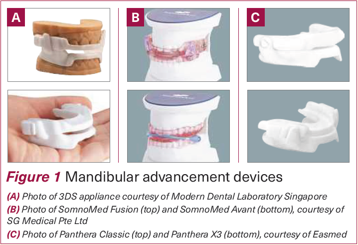 Mandibular advancement devices (MADs) - NDCS