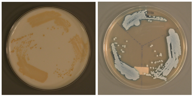  ​The novel type of Candida auris grown on different types of culture media. (PHOTO A*STAR's Genome Institute of Singapore) 