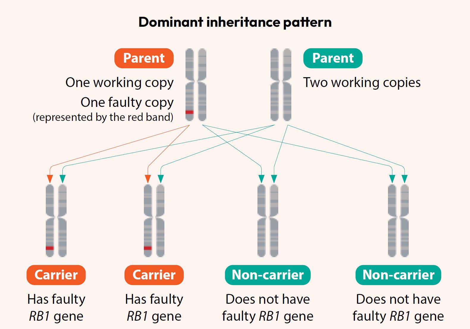 Dominant inheritance pattern-Heritable Retinoblastoma
