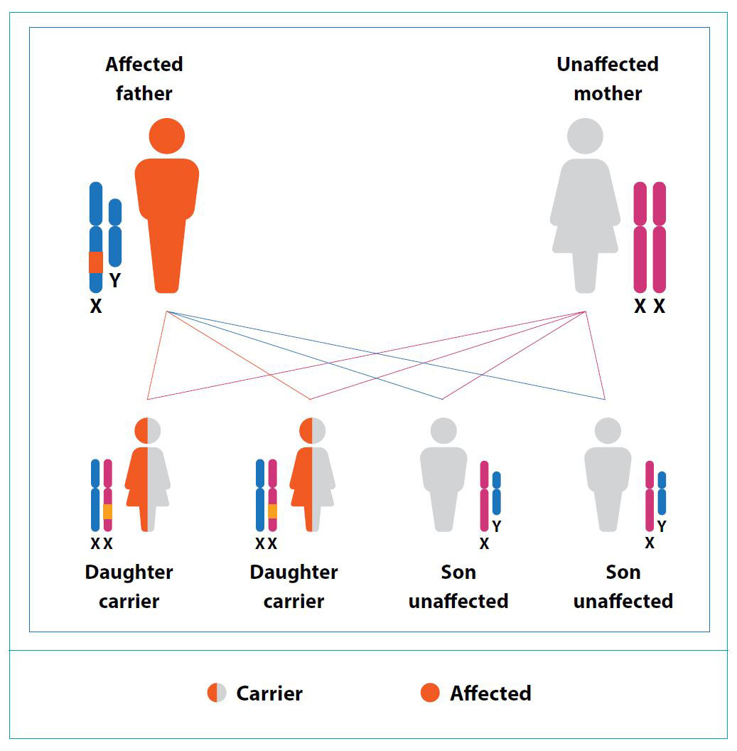 X-linked Inheritance - Affected Male (One Copy Affected)