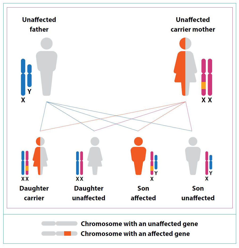 X-linked Inheritance-Female Carrier (One Affected Only)