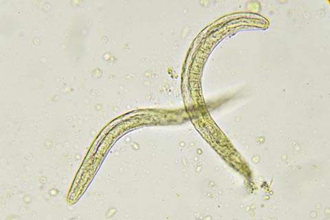 pinworms conditions & treatments
