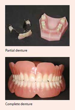 Dentures treatment at National Dental Centre Singapore