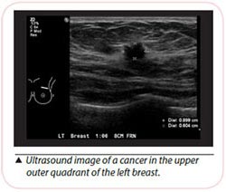 breast cancer diagnosis ultrasound