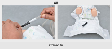 connect the catheter to urine bag