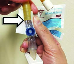 change urine bag - clean urine catheter
