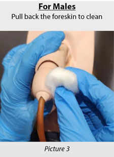 for males - washing genital area around the catheter
