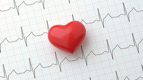 a diagram of abnormal heart rhythm