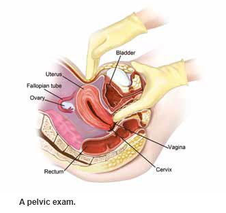 Menorrhagia pelvic examination - condition and treatment SingHealth